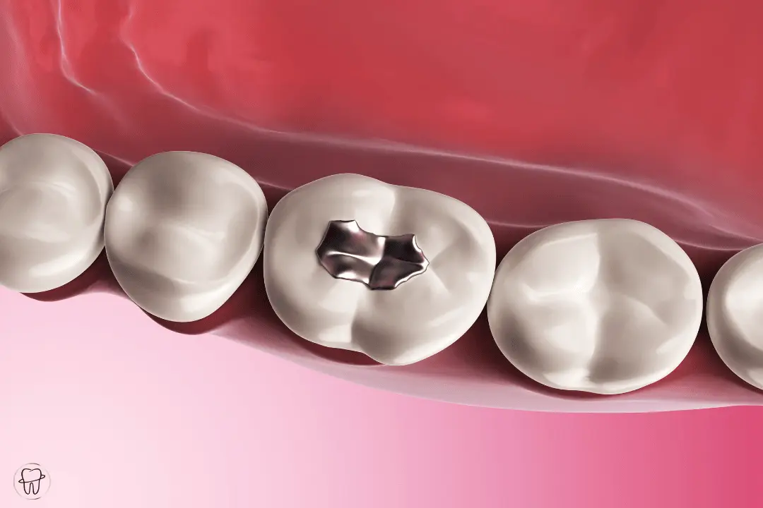 Oral Chirurgie in der Zahnarztpraxis Oerlikon